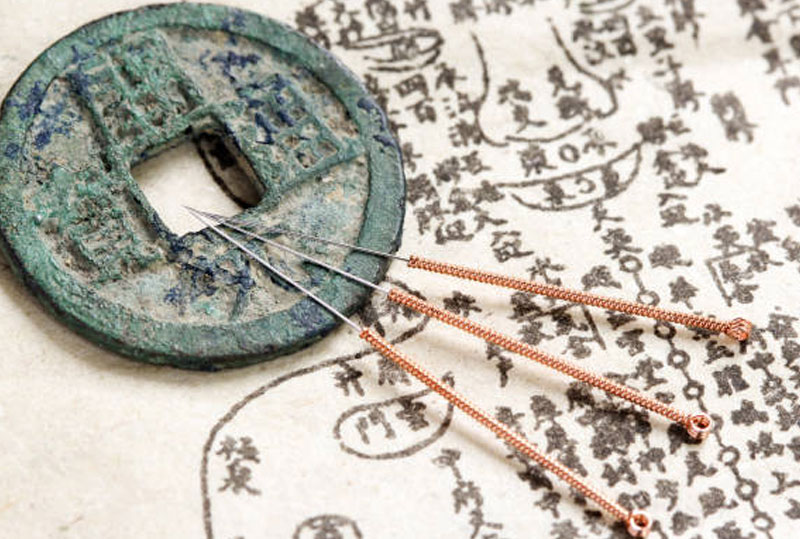 acupuncture Prescott AZ